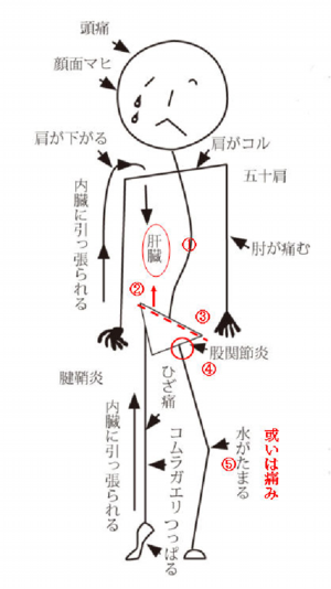 経筋腱収縮牽引の原理図.png